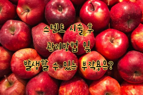 스텐트 시술 후 관리방법 및 부작용