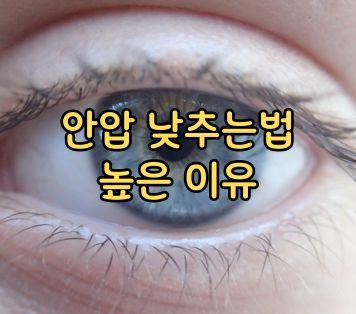 안압 낮추는법 높은 이유