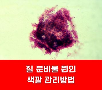 질 분비물 원인 색깔 관리방법